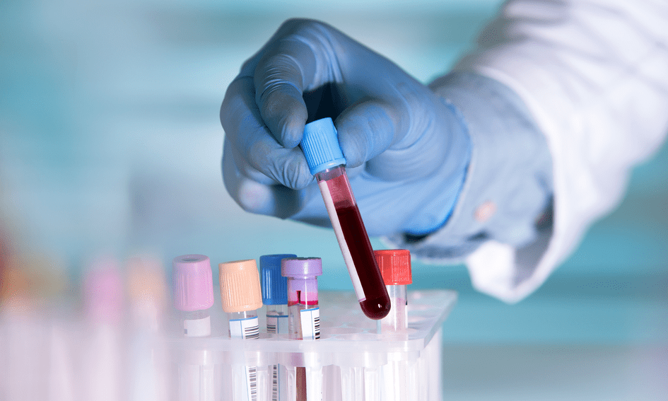 lab-technician-holding-a-blood-sample